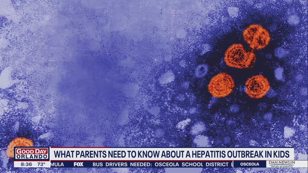 What parents need to know about a Hepatitis outbreak in kids